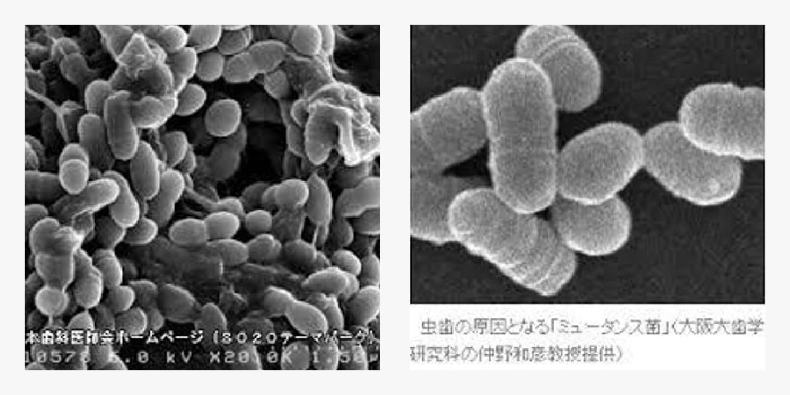 お口の２大疾患といえば虫歯と歯周病