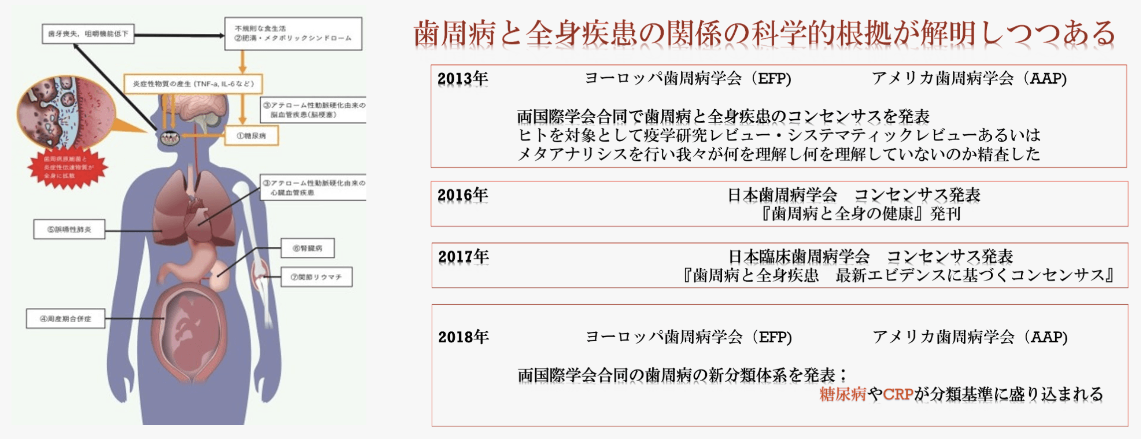 口腔の健康と全身の健康の関係